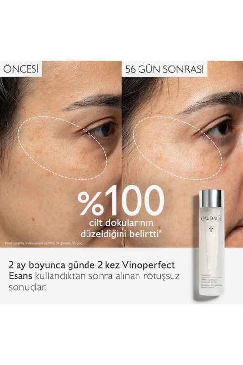 Caudalie Vinoperfect Leke Karşıtı ve Işıltı Verici Glikolik Esans 100 ml