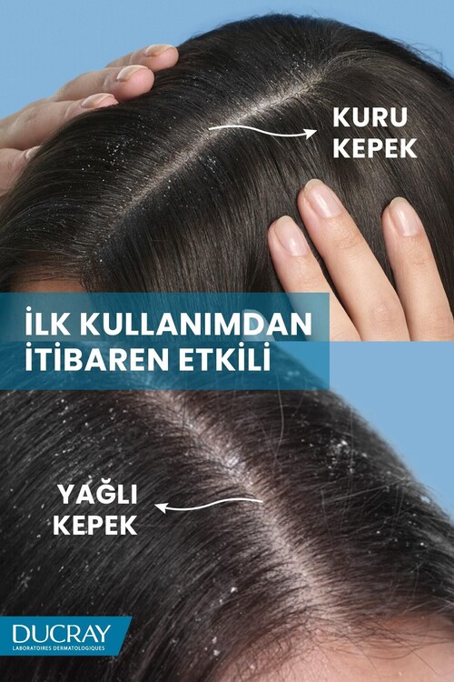 Ducray Kelual Squanorm Kepek Karşıtı Losyon 200 ml
