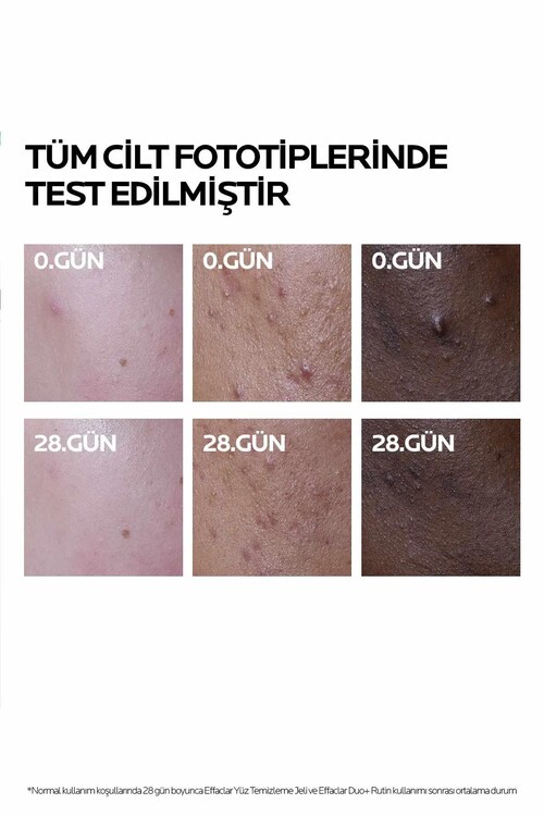 La Roche-Posay Effaclar Duo (+) 40 ml - Cilt Bozukluğu ve Akne Lekelerine Karşı Düzeltici Bakım